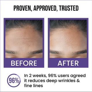 0.5% Retinol Anti-Ageing Face Serum