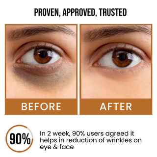 Dark Circle & Spot Reduction Face Serum