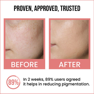 Brightening & Skin Repair Face Serum