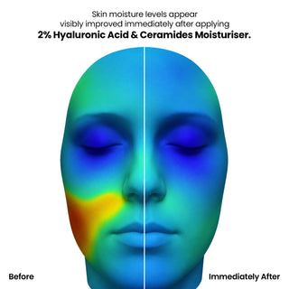 2% Hyaluronic Acid & Ceramides Moisturizer