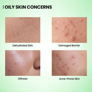 Matcha Oil-Free Moisturizer