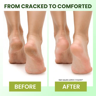 Foot Cream