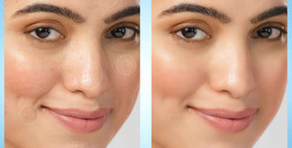 5% Niacinamide & Ceraminde Toner
